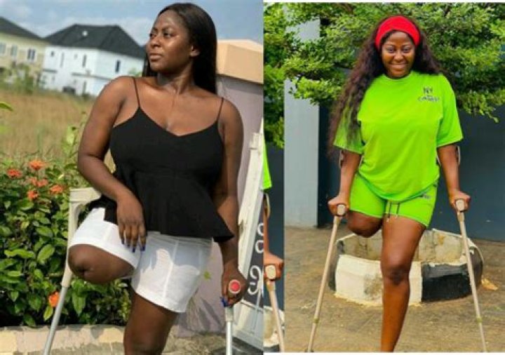 "Actress Doris: White men are attracted to my amputated leg and pay me in dollars"