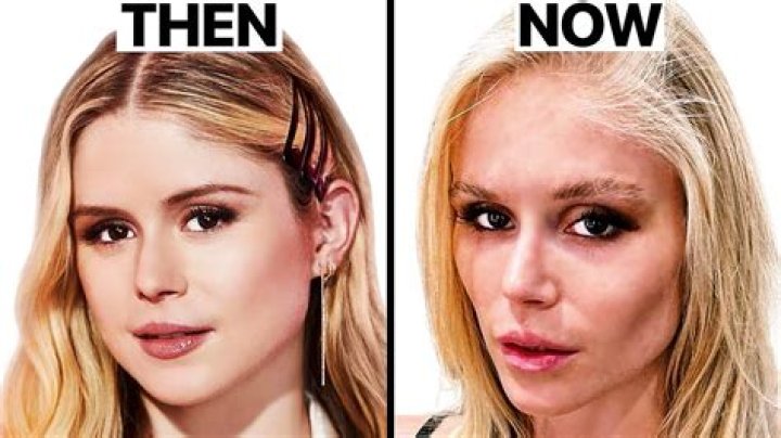Alicia Aylies Before And After, Did Alicia Aylies Had Plastic Surgery? Check Alicia Aylies Age, Instagram, Height