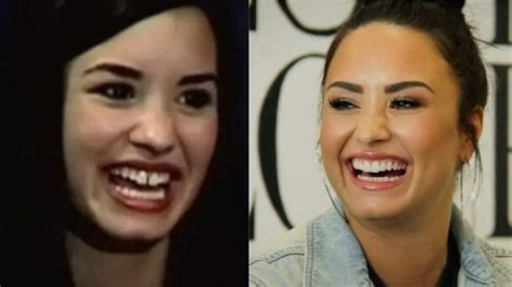 Demi Lovato regrets getting teeth 'fixed' for film role