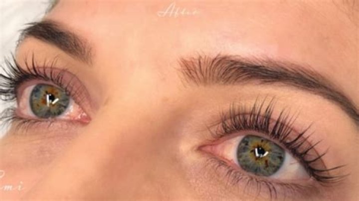 Eyelash serum EyEnvy sprung over ingredient, pulled in Canada