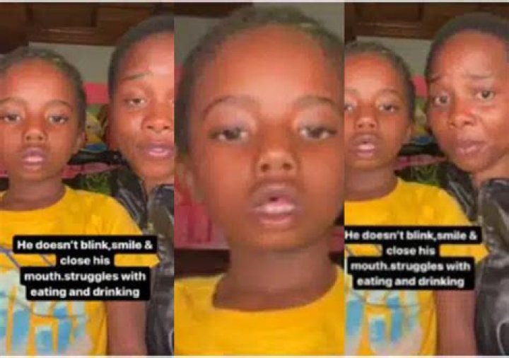 For over 7 years my son hasn’t blinked, smiled or closed his mouth – Mother seeks help