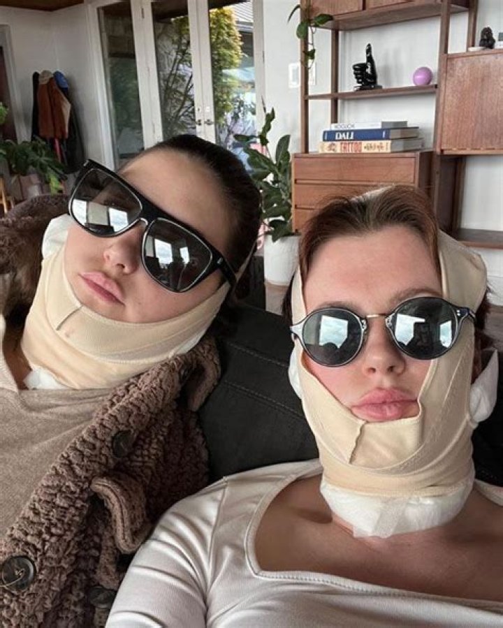 Ireland and Alaia Baldwin divide fans with shocking surgery pictures