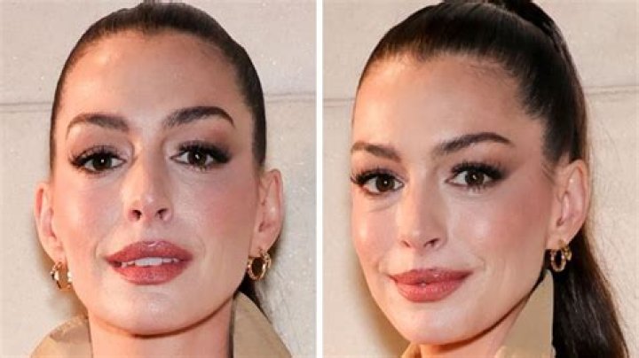 Julie Bowen plastic surgery: Modern Family star reveals what she’s had done