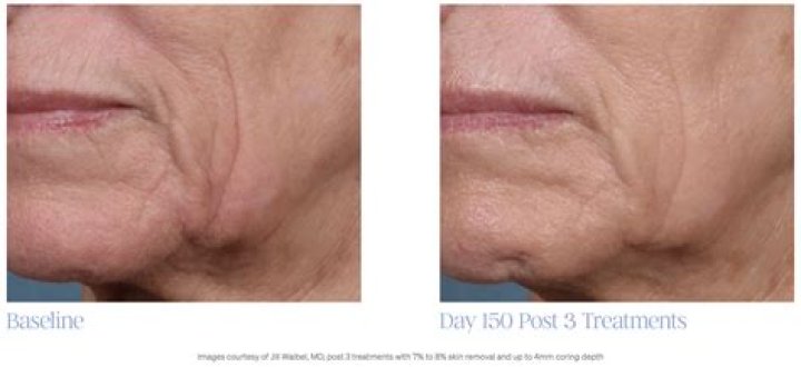 Micah Lussier Plastic Surgery Overview